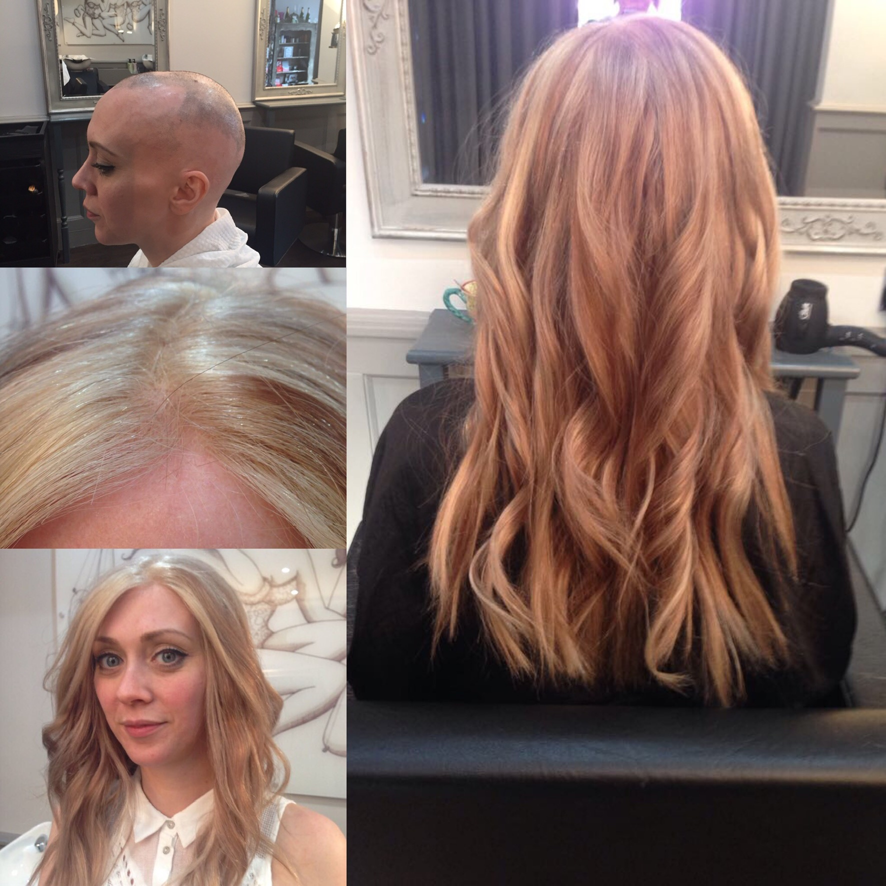 Hair replacement with blonde hair on woman