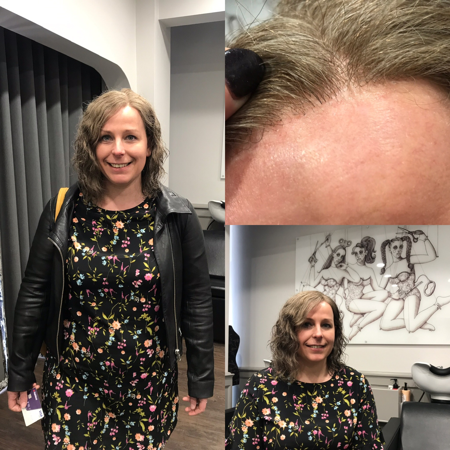 Hair replacement with brunette short hair on woman